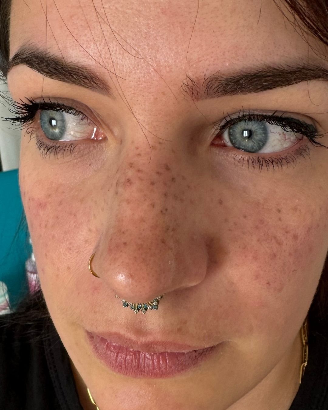 Taches de rousseur peau nue SabyDermoBeauty