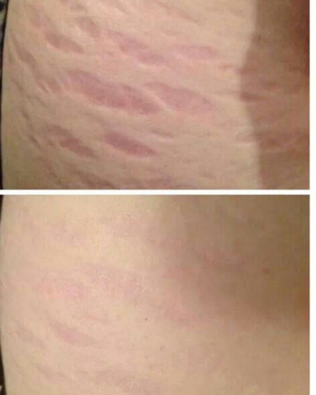 maquillage permanent levres saint gilles-croix-de-vie, Sabrina Maudemain, vendée, MAQUILLAGE PERMANENT BOUCHE, LA ROCHE SUR YON? BRETIGNOLLES SUR MER, dermopigmentation, SabyDermoBeauty, INSTITUT CANCEROLOGIE DE L'OUEST, NANTES, CHALLANS, COEX, 