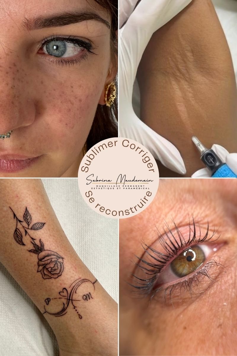 Sabrina Maudemain pigmentation post-cancer en Vendée